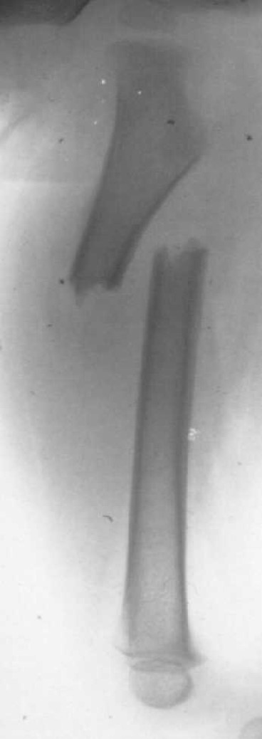 Tag0